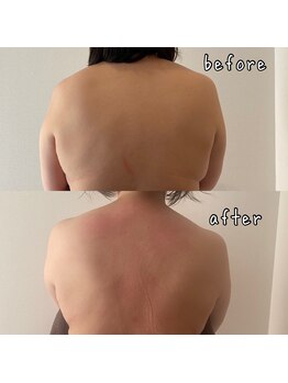 プレジール(Plaisir)/アロマトリートメント