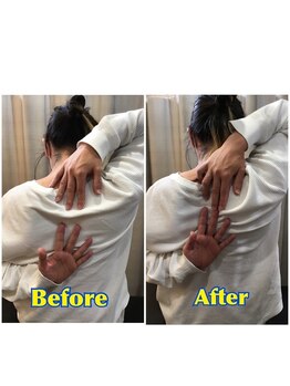 くすの樹接骨院 整体院 多 布施院/整体/骨盤矯正ビフォーアフター