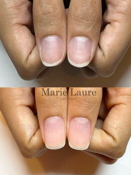 マリーロール 淀屋橋本店(Marie Laure)/自爪育成/深爪矯正/ネイルケア