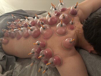 サロンリーナ 銀座店(SalonLena)/カッピング