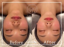 R-1ビューティーサロン 表参道/Before＆After