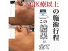 当店NO.1/50代老け顔卒業◎シミ/たるみ-１０歳美肌へ★初回体験価格