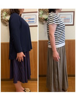 リンドール(RinDoll)/50代女性ダイエット/耳ツボ/痩身