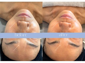 ステラ(STELLA)/ゾンビマスク