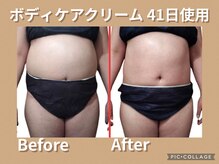 ボディリカバリー(Bodyリカバリー)/