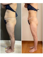 エミニー バイ エルズ(Eminy by L★s)/50代　セルゼロ全身　27回