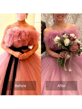 すみれ鍼灸整骨院/神戸 ブライダル美容整体