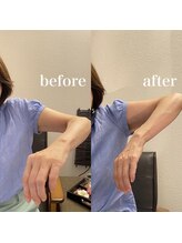 サロン ド ブリーズ(salon de breathe)/施術前後のお写真