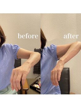 サロン ド ブリーズ(salon de breathe)/施術前後のお写真