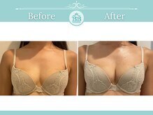 ベルビューティー(belle beauty)/【サイズアップ★D以上】