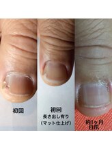 リノール(Linol)/