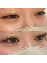 リリー(Lily)/上下まつパ