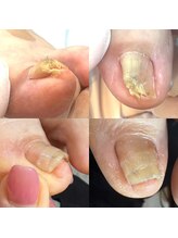 ウェルズユキ(well's yuki)/