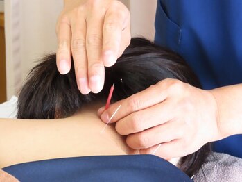 はやかわ鍼灸整骨院の写真/長時間同じ姿勢で緊張感が抜けない首・肩こり・頭痛に鍼施術でメンテナンスを◎