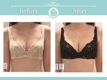 美人バスト 仙台店/【バストアップ/育乳　症例】！
