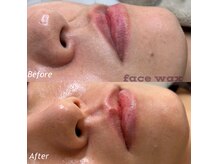 チャム(chum)の雰囲気（フェイスワックスで艶肌モチ肌へ！韓国発ラミネーションピールも）