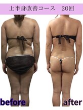 リラ(Lilas)/背中に自信がつく！