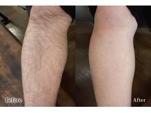 アネル 豊見城(anel)/