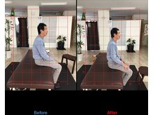 ストレチックス 近江八幡店/姿勢改善ビフォーアフター1回