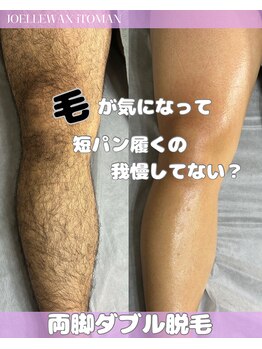 ジョエルワックス 沖縄糸満店(JOELLE WAX)/メンズも脱毛の時代