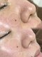 スナイ(SNAY)の写真/【結果重視エステ】上質で落ち着いた空間、肌と丁寧に向き合う時間を。大人女性のための美肌エステ
