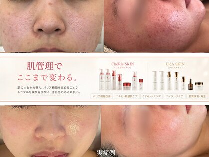 グレーシス(Graces)の写真