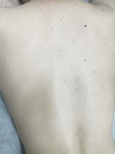 ナノハナ/鹿沼市の全身脱毛美容室ナノハナ