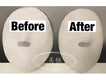 美極 トータルビューティー(美極 TOTAL BEAUTY)/恵比寿/小顔コルギ/エステ/