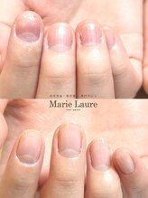マリーロール 梅田店(Marie Laure)/自爪育成/深爪矯正/ネイルケア