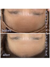 アンドナップ(nap)/スキンケアフェイシャルワックス