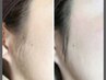 美肌フェイシャルWAX（全体）◇潤いパック付5,000円