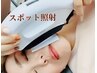 スポットシミケア！1箇所　¥3,300