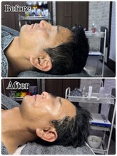 カルナ(CARNA)/初回のお客様のBefore&After