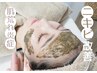 《No.1ハーブピーリング》しぶとい肌荒れニキビケア◎一気に撃退19800→15900