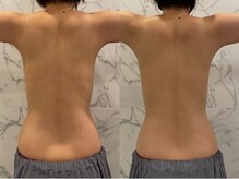 エーアイビューティー 御徒町店(Ai Beauty)/ 【バストアップ例】