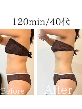 米香(MAIKA)/120分/40代/12回/-7キロ