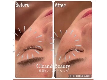 クリーンアンドビューティ 札幌(Clean&Beauty)/他店で改善されなかったお悩みに