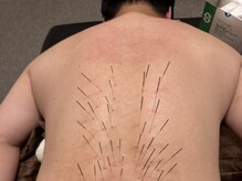 はり処堂 弥勒