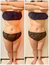 フーガ 宇都宮店(fu-ga)/やみつき 美骨リンパマッサージ