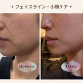 アイチューズ(ICHOOSE)