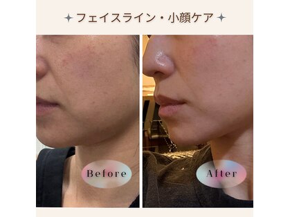 アイチューズ(ICHOOSE)の写真