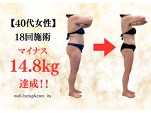 イタ 岡崎店(ita)の雰囲気（【マイナス14.8kg達成】結果が出る当店人気No.1の"インド式痩身"）