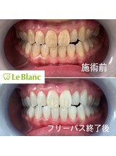 ルブラン 奈良店(Le Blanc)/黄ばみの原因は様々！