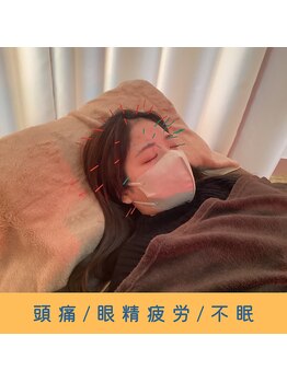 いつつのき/頭皮鍼