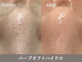 RHB東戸塚/小顔エステはRHB東戸塚