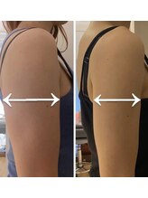 ホワイティアビシェル 浦和(Whitia Vishell)/浦和痩身