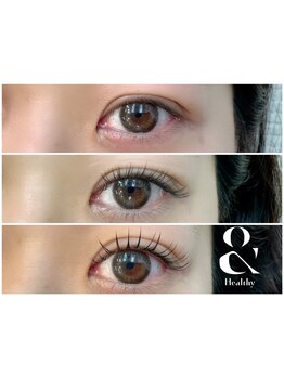 まつげのお悩み解決サロン