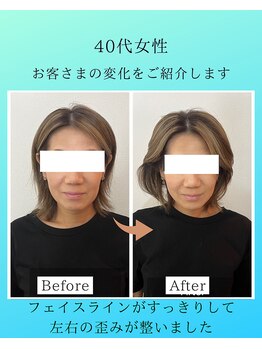 マハロ 海老名店(Mahalo)/小顔矯正　40代