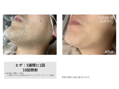 ルミナ(LUMINA)の写真