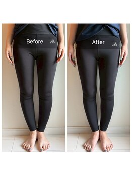 ライトワーク 西新宿店/O脚矯正